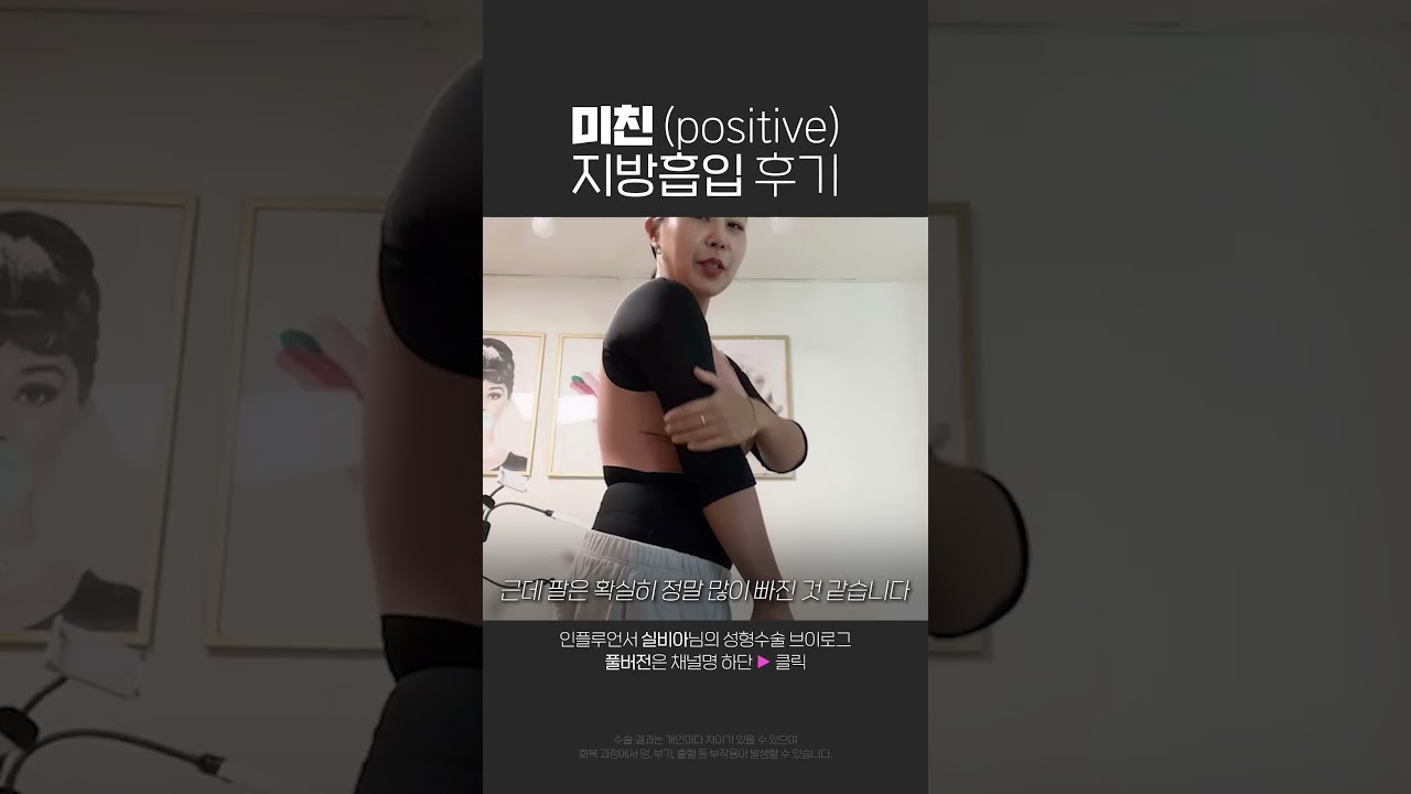 [Thẩm mỹ viện Very Good] Bài đánh giá thực tế về hút mỡ "điên rồ" (tích cực) của influencer 'Sylvia'!