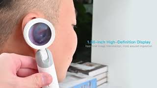 1 38'' Ear Camera Wit IPS Display and 1080P Camera Ear Check Portable Inspector for Ear Mouth Pet Wi