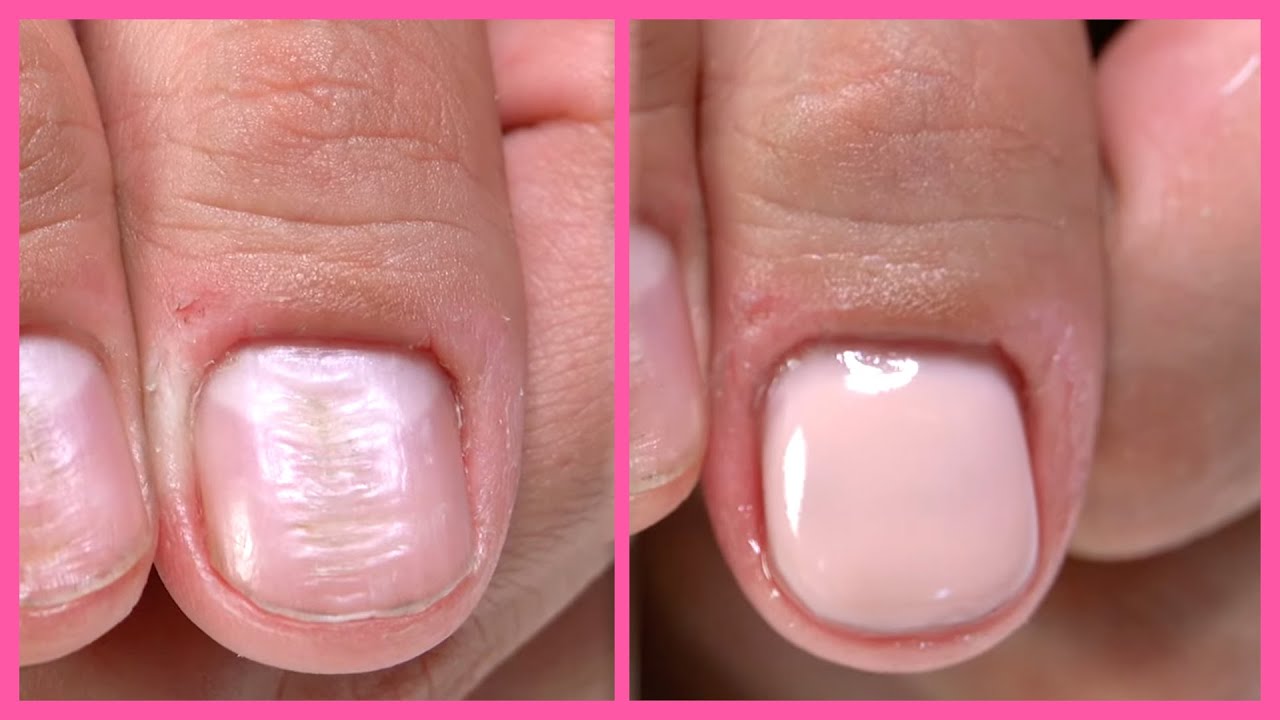 Things To Do Before Getting Acrylic Nails - Your Fake Nail Guide
