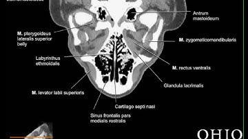 Virtual Pig Head - CT scan - horizontal slice animation