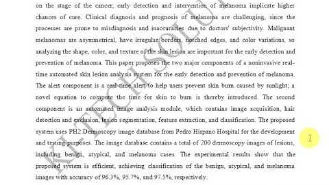 NONINVASIVE REAL TIME AUTOMATED SKIN LESION ANALYSIS SYSTEM FOR MELANOMA EARLY DETECTION