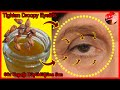 Honey Botox Cream! In a Week, Tighten Droopy Eyelids and Reduce Wrinkles Around Eyes