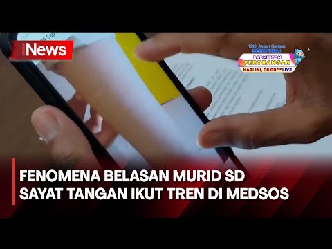 Belasan Siswa SD di Situbondo Ikutan Trend Viral di Medsos Sayat Tangan Sendiri