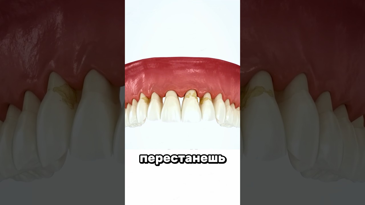 Почему важно чистить зубы?