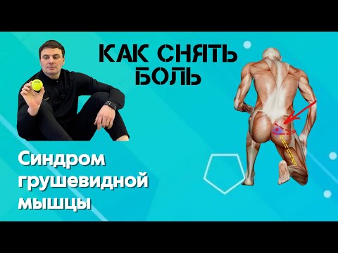 Piriformis Syndrome: How to Relieve Spasms and Pain