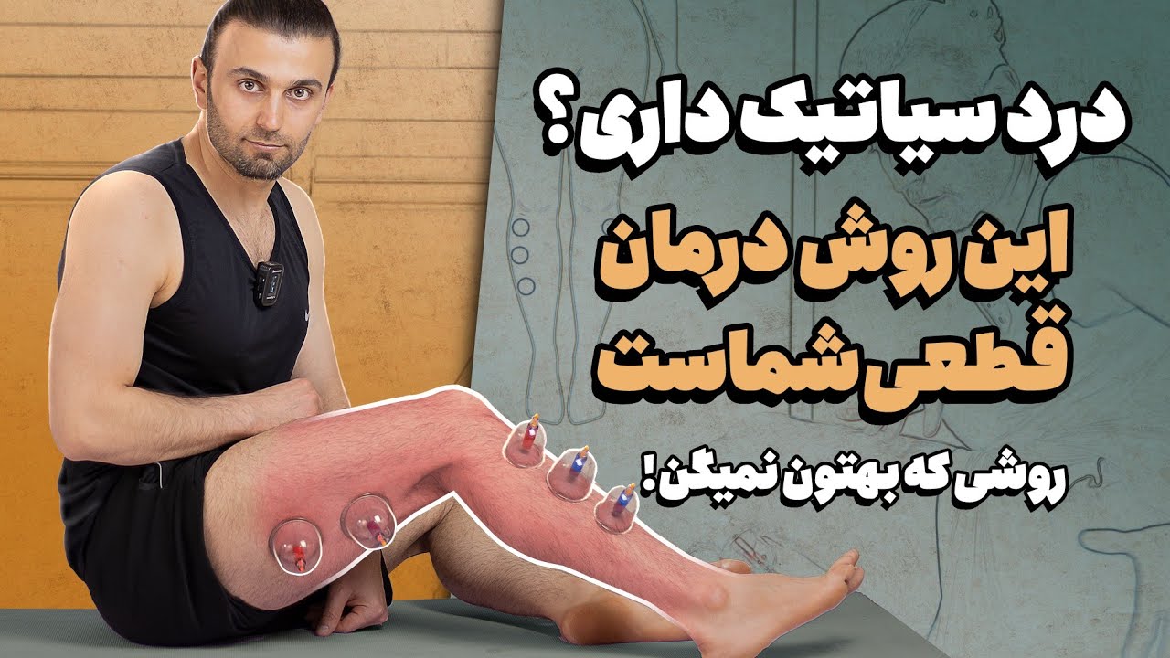 درد سیاتیک رو با این روش طبیعی درمان کن! (بدون دارو، بدون جراحی)