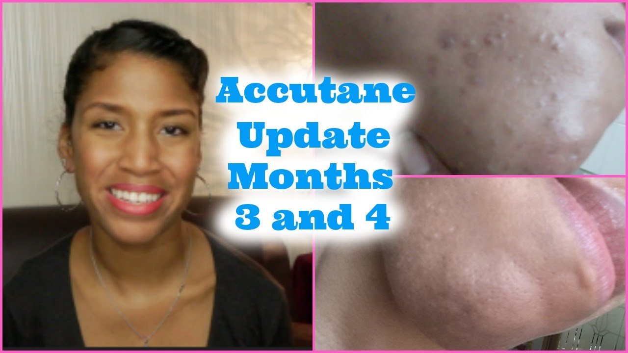 ACNE UPDATE: Skin Care in Korea Months 3 and 4 - YouTube
