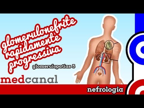 Video: Glomerulonefrite Nei Gatti