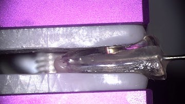 alcohol vs oil to facilitate US broken file removal