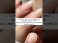 Λόγοι για τους οποίους θολώνει το τοπ Nails/Νύχια