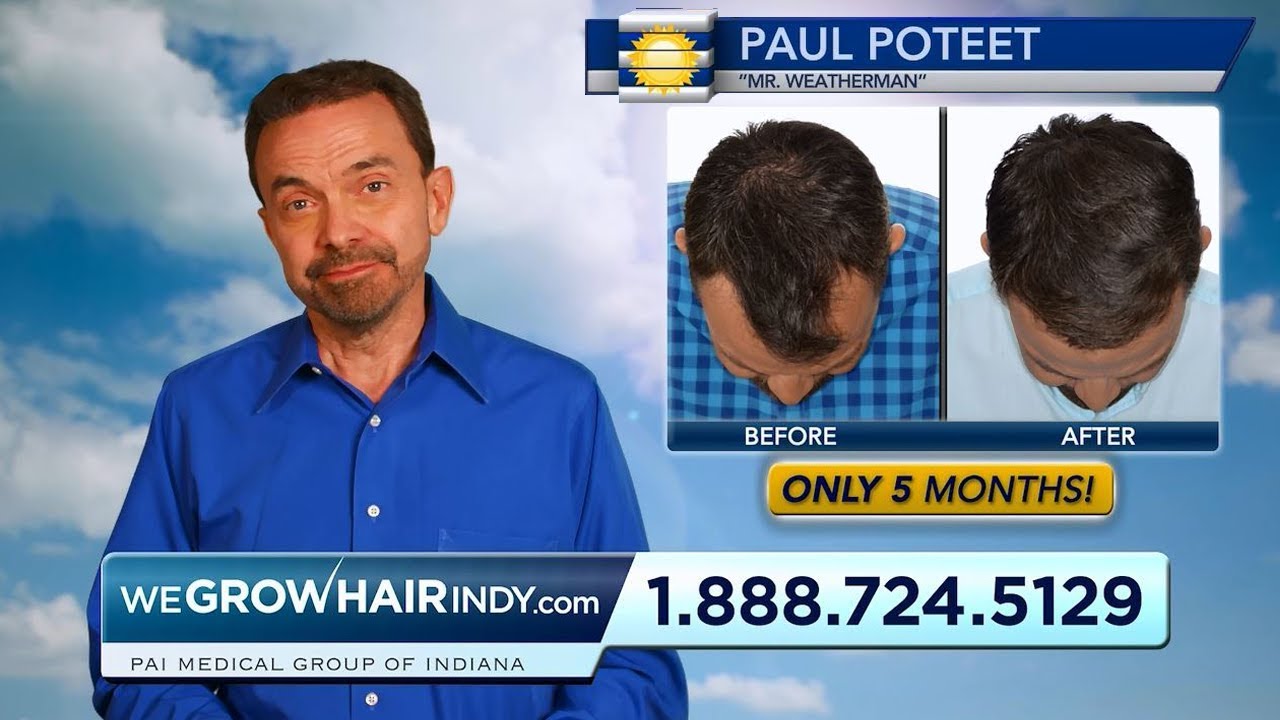 More hair in the forecast! Paul Poteet (Mister Weatherman) YouTube