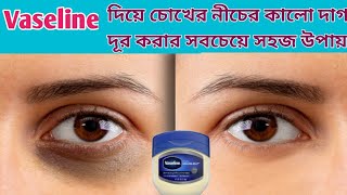 Vaseline দিয়ে ৫ মিনিটে চোখের নীচের কালো দাগ দূর করার সহজ উপায়/ ডার্ক সার্কেল দূর করার উপায়। screenshot 3