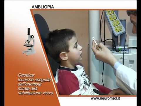 Video: Ambliopia Negli Adulti E Nei Bambini: Tipi E Gradi, Diagnosi, Trattamento