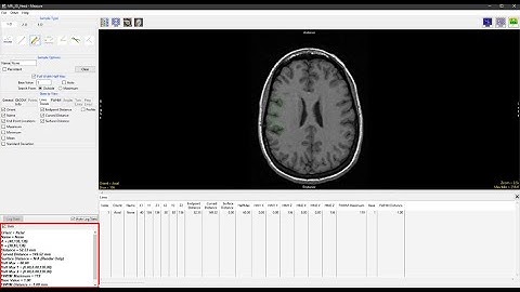 Analyze 15.0 - Measure: Sample Traces