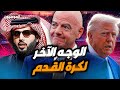 كرة القدم رياضة أم سياسة أم إقتصاد