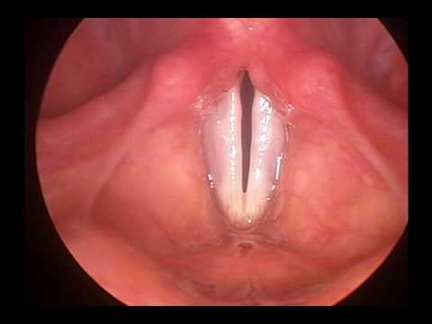 Vocal Cords - YouTube