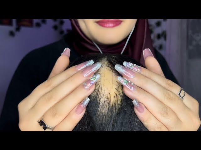 ASMR Satisfying Scalp Scratching In 30 MIN 💆🏻‍♀️ (head massage, no talking) For Deep Sleep 