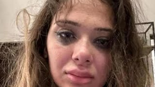 Merve Taşkinin Şi̇ddet Görmesi̇