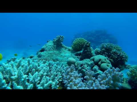 Video: Australo Stebuklingai Neįkando Mažas, Bet Mirtinas Aštuonkojis Kišenėje