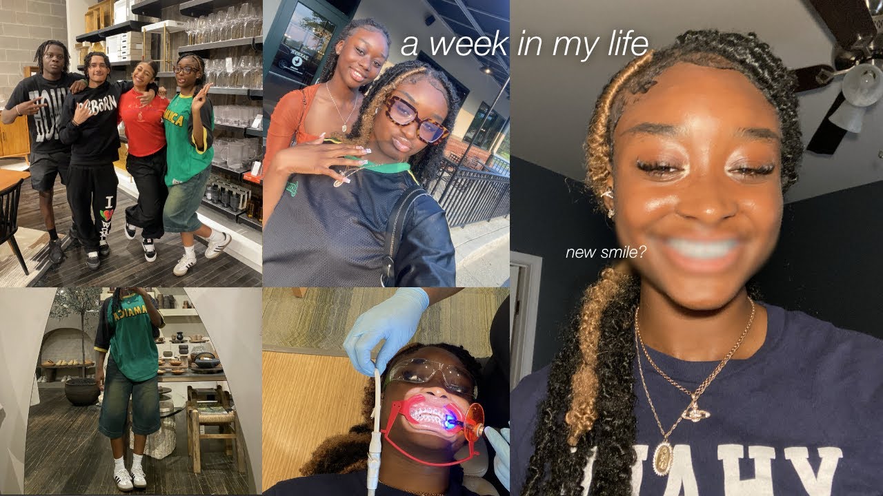 getting braces for the first time...  | iconikki