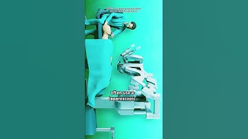 Ovarian Cystectomy(3D Animation