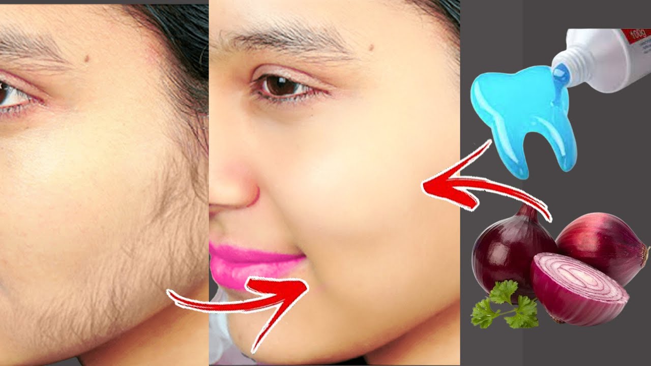 Stop shaving! Here's how to permanently get rid of facial and body hair