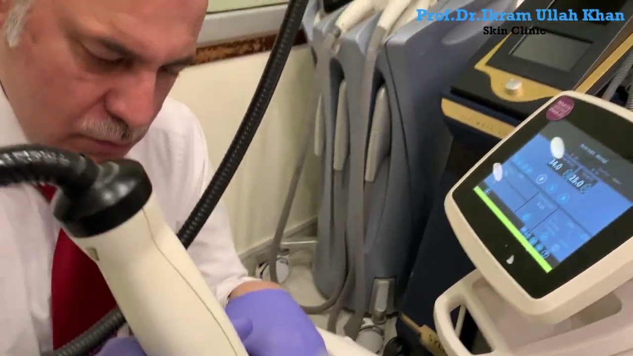 From DEEP Scars to FLAWLESS Skin: MUST SEE This Laser Transformation! 