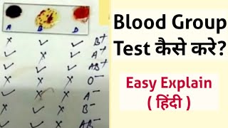 Blood Group Test in Hindi | Blood Group Test kaise hota hai