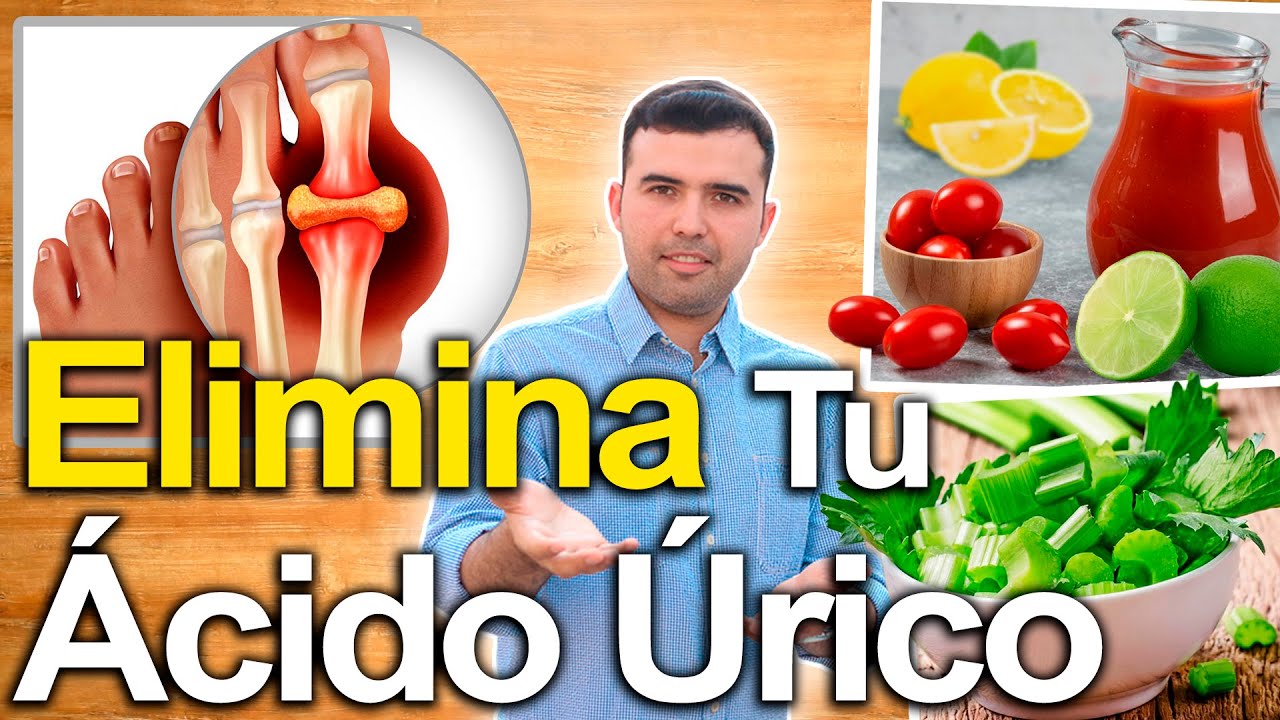 Elimina El �cido �rico Y Gota En 1 Semana - C�mo Bajarlo Con Jugos Y Alimentos