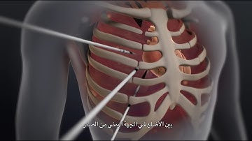 Minimally Invasive Valve Repair