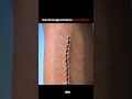 How Surgical Sutures hepls in Healing? 🤔 #MedicalInnovation #SurgicalTech  #science