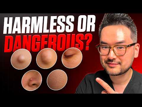 视频封面：这个小疙瘩是什么？皮肤科医生讲解 8 种常见皮肤赘生物