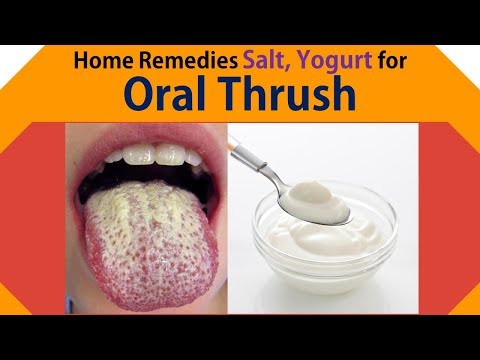 home-remedies-for-oral-thrush-|-get-rid-oral-thrush-with-salt,-yogurt