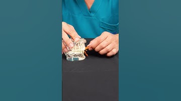 Đồ Ăn Nào Tốt Cho Răng Sứ? Hãy Cùng Thử Với Bento Nhé! | Dr Cường Official