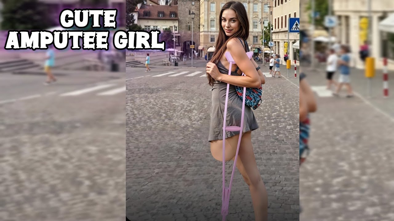 Девочка с ампутированной конечностью учится любить свое новое тело: путь от потери к обретению си...