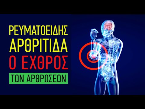 Βίντεο: Τι σημαίνει ρευματοειδής παράγοντας;