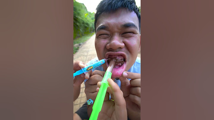 Người Chị Tốt Bụng làm Bác Sĩ Khám Răng cho Em Ăn Kẹo Mút Sâu Răng / Funny Video Eat Candy