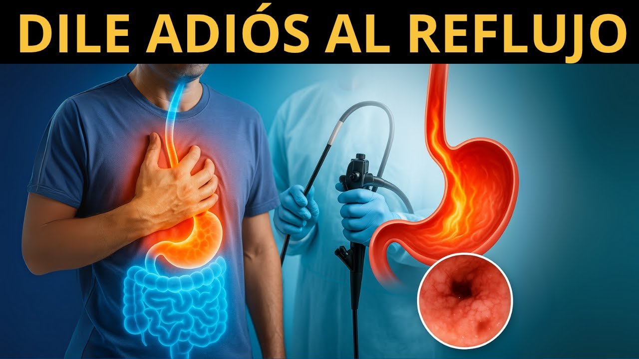Elimina el Reflujo Gástrico NATURALMENTE