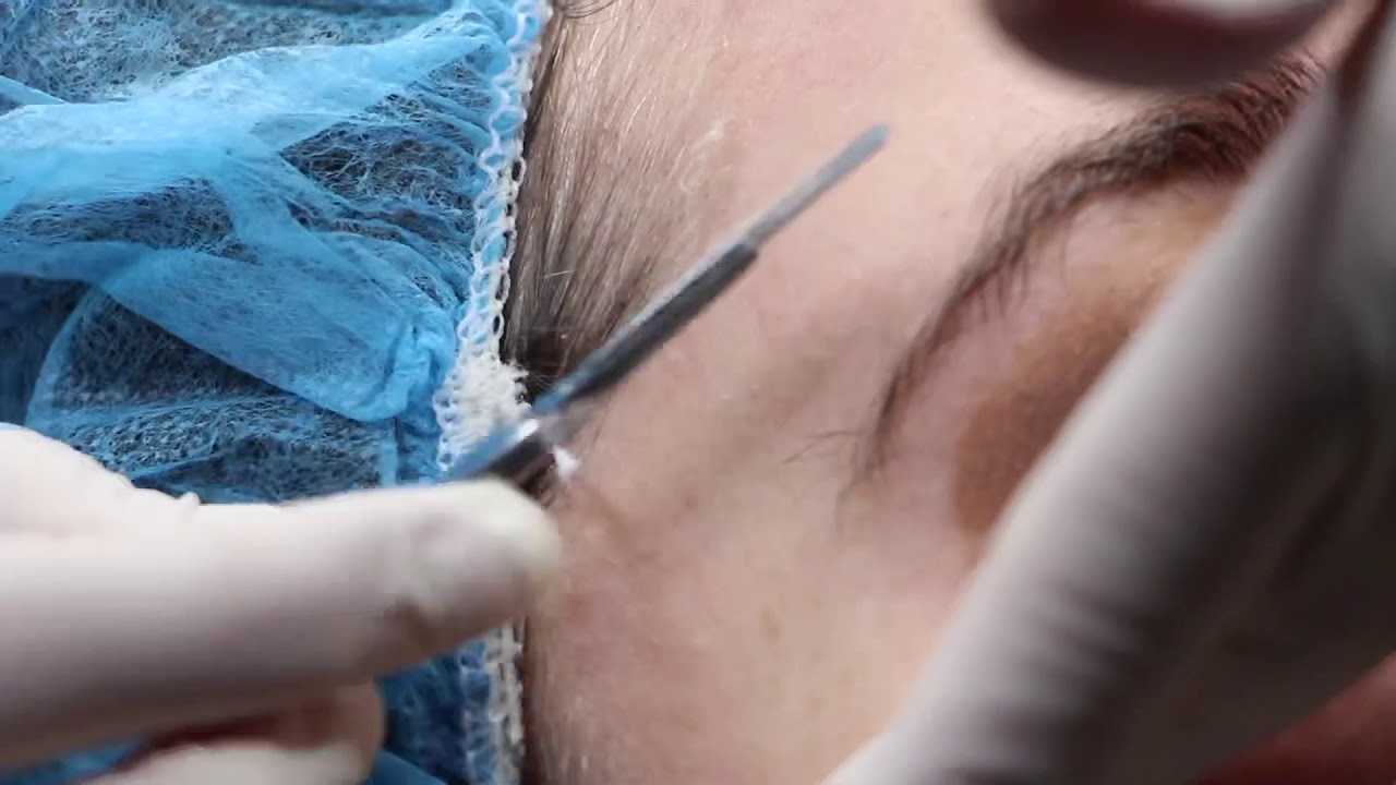 Banner for Dermaplaning Skin Care Treatment