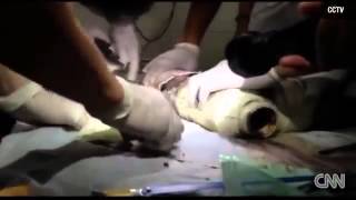 Shocking Video Of Newborn Baby Rescued From Sewer Pipe(An abandoned newborn baby boy found trapped inside a sewage pipe after being flushed down the toilet was today being nursed back to health in hospital., 2013-05-28T22:27:37.000Z)