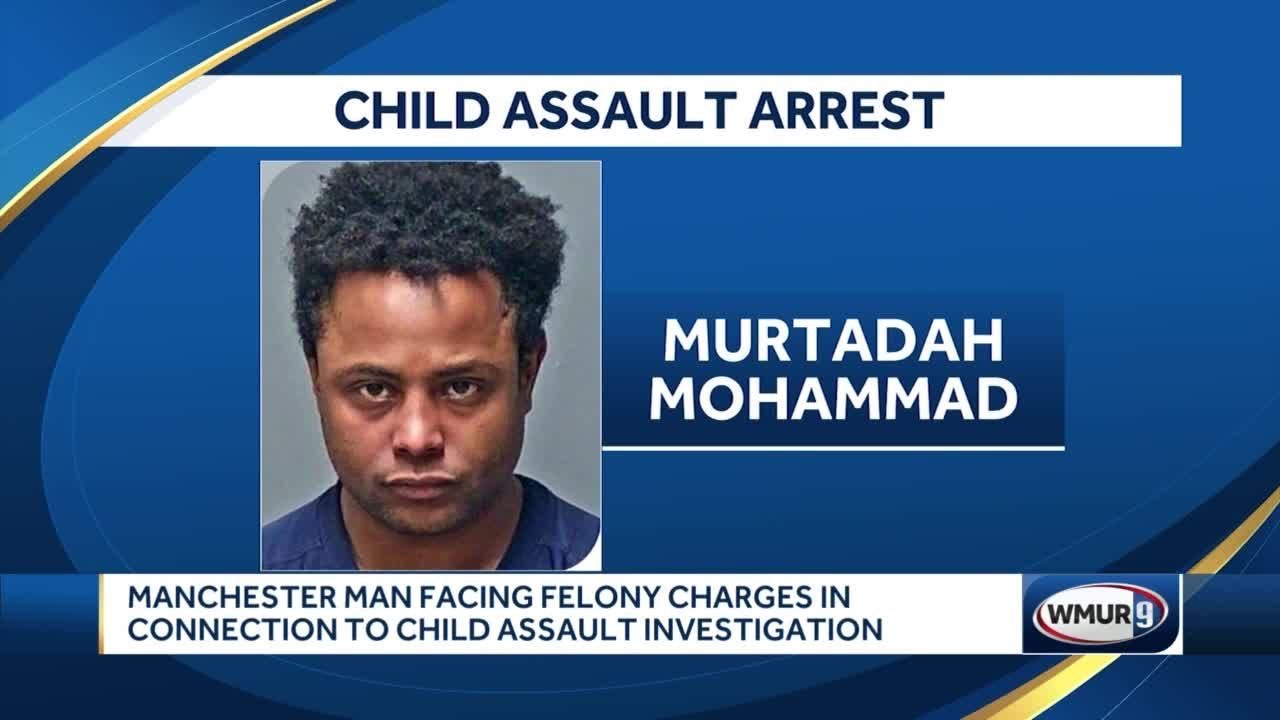 Man faces felony charges after boy found seriously burned - YouTube