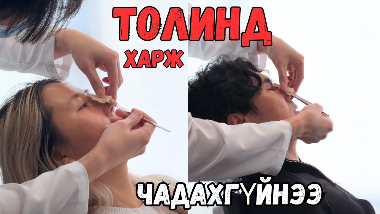 ГИПСЭЭ АВСАН ӨДӨР😳