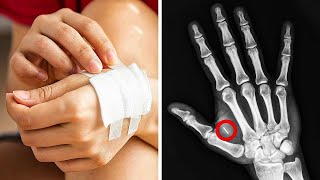 10 MICROCHIP IMPLANTS CHANGING HUMAN LIFE