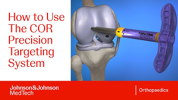 COR Precision Targeting Cartilage Repair System: Stapsgewijze handleiding | DePuy Synthes
