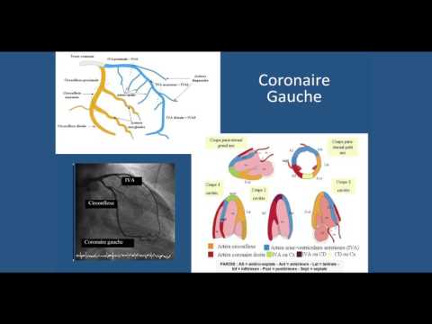 Vidéo: Angiographie Coronarienne - Indications, Contre-indications