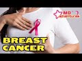 The Breast Cancer