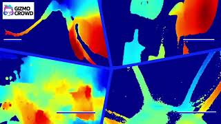 🔬 iMic3D – Real-Time 3D Microscopy Without Glasses or Lasers!