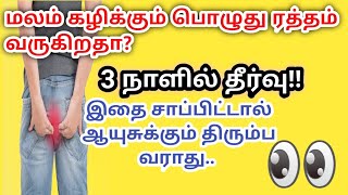 மலத்தில் ரத்த கசிவு ஏற்படுகின்றதா? தீர்வு என்ன? | Blood in Stool | Rectal Bleeding