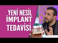 Hayat kurtaran implantlar... İmplant yaptırmak isteyenler nelere dikkat etmeli?