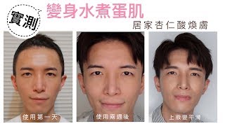 居家杏仁酸煥膚 | 變身水煮蛋肌 feat. Dr.Douxi朵璽